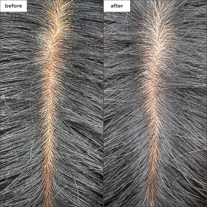 Picture of Briogeo Scalp Revival Charcoal + Coconut Oil Micro-Exfoliating Shampoo 59ml
