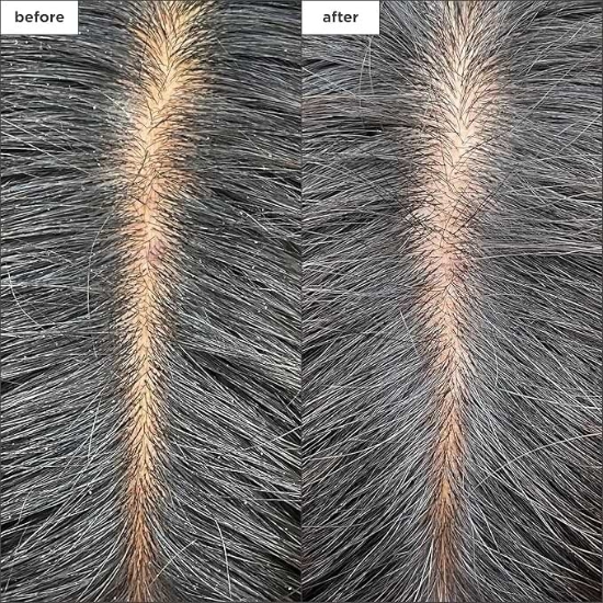 Picture of Briogeo Scalp Revival Charcoal + Coconut Oil Micro-Exfoliating Shampoo 59ml