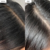 Picture of Briogeo Scalp Revival Charcoal + Tea Tree Buildup Detox Spray 120ml