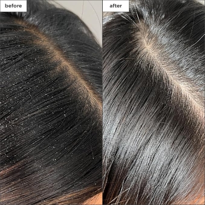 Picture of Briogeo Scalp Revival Charcoal + Tea Tree Buildup Detox Spray 120ml