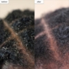 Picture of Briogeo Scalp Revival Charcoal + Tea Tree Scalp Treatment 30ml