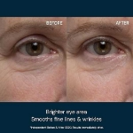 Picture of Elemis Pro-Collagen Eye Revive Mask 30ml
